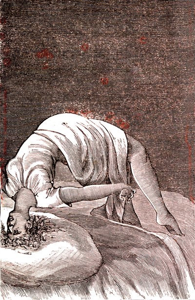 Hysteri, psykisk och nervös störning, som härrör från intensiv ångest. 1887 (gravyr) av French School