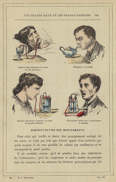 Förtäring av ett läkemedel med hjälp av matröret, rökning med tekanna, balsamsyra och gasinandning, med hjälp av inhalatorförgasaren, Reaktiv sprutning med reaktionssprutan (färg litho) av French School