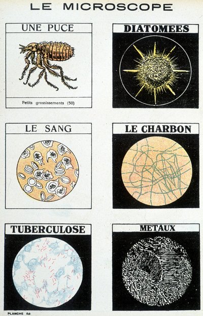 Mikroskop: ett chip, kiselalger, blod, kol, tuberkulos, metaller. av French School