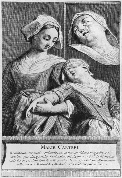 Mirakulöst helande av en blind kvinna, Marie Carteri, på diakon Francois de Pariss grav på församlingskyrkogården Saint-Medard i Paris av French School