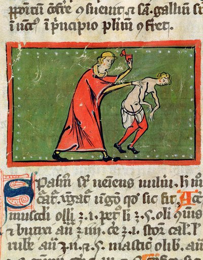 Ms H 89 Doktor som behandlar en patientrygg, från en upplaga av Book of Surgery av Rogier de Salerne av French School