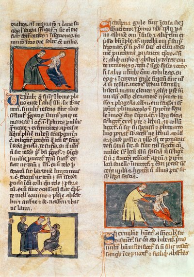 Ms H 89 fol.17r Surgery, från en upplaga av 