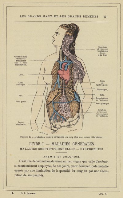 Organ för blodproduktion och cirkulation hos en klorotisk kvinna (färg litho) av French School