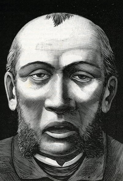 Patient med cerebral uppmjukning (gravyr) 1888 av French School