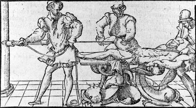 Minskning av dislokation, -i "Medical Treaty of Ambroise Paré"", cirka 1560. av French School