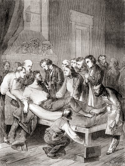 Den första offentliga demonstrationen av användningen av inhalerad eter som ett kirurgiskt bedövningsmedel 1846 av en amerikansk tandläkare, William Thomas Green Morton, från 