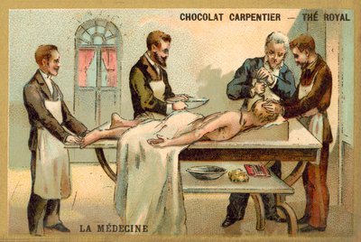 Trepanning (chromolitho) av French School