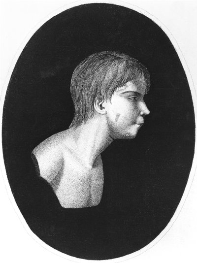 Victor of Aveyron, frontispice av De lEducation dun homme sauvage av J.E.Itard av French School