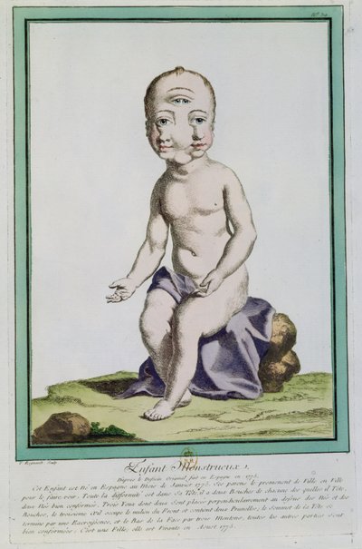Barn med missbildat huvud, från "Les Ecarts de la Nature", Paris, 1775 av Genevieve Regnault de Nangis