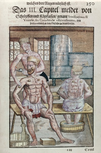 Koppning, från Ophthalmodouleia av Georg Bartisch (1535-1636) publicerad i Dresden 1583 (träblock i färg) av German School
