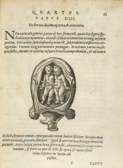 Icke-identiska tvillingar i livmodern, illustration från kapitel 14, bok 4 i On the Conception and Growth of Man av Rueff, 1587 av German School