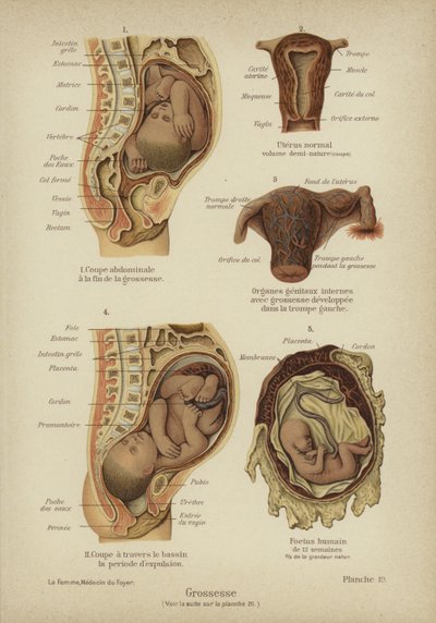 Graviditet (färg litho) av German School