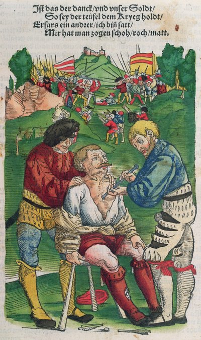 Att ta bort en pil, illustration från Feldtbuch der Wundartzney av Hans von Gersdorff, 1540 av German School