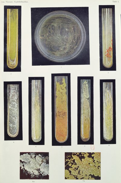 Syphilus Bacillus, från en bok av Max von Niessen, Leipzig, 1908 av German School