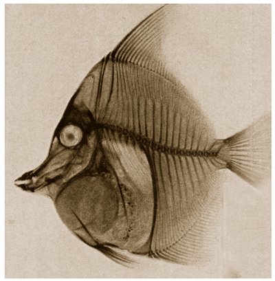 Röntgen av en fisk ca 1890 av German School