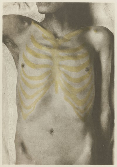 Anatomisk foto av een manlijk lijk: 