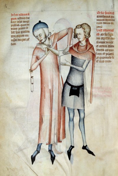 Kirurgi: läkare undersöker sin patients leder genom att sträcka en arm (osteopat). Miniatyr i ""Liber notables Philippi den sjunde kungen av frankerna, extraherad från Galiens böcker"" skriven av Gui (kille) av Pavia av Guido da Vigevano da Pavia