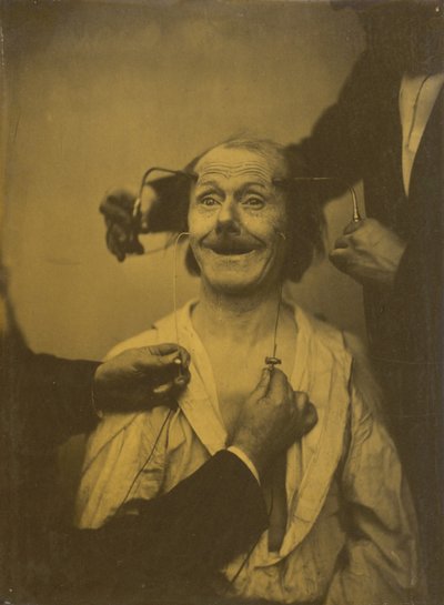 Ein falscher, unvollständiger Ausdruck angenehmer Überraschung oder Bewunderung von Guillaume-Benjamin-Armand Duchenne de Boulogne