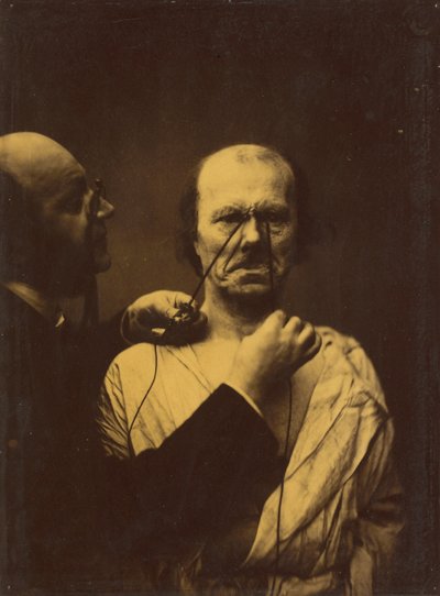 Aggression, Bosheit, 1854-1856, gedruckt 1862 von Guillaume-Benjamin-Armand Duchenne de Boulogne