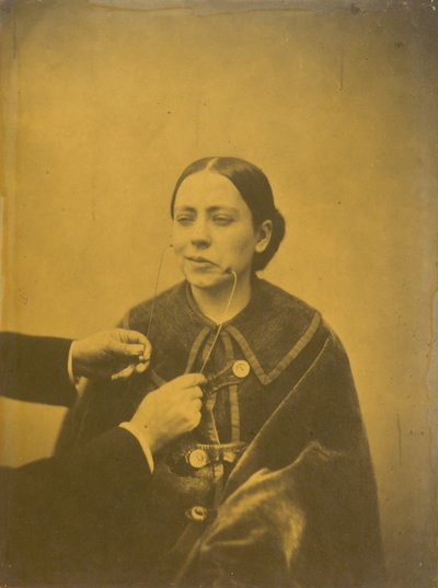 Verächtlicher Ekel (links); Verächtliches Lachen (rechts), 1854-1856, gedruckt 1862 von Guillaume-Benjamin-Armand Duchenne de Boulogne