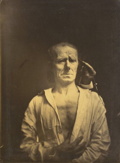 Krampf des M. corrugator supercilii unter sehr starkem Licht (links); Ein entspanntes Gesicht (fotografiert im vollen Sonnenlicht) (rechts), 1854-1855, gedruckt 1862 (Foto) von Guillaume-Benjamin-Armand Duchenne de Boulogne