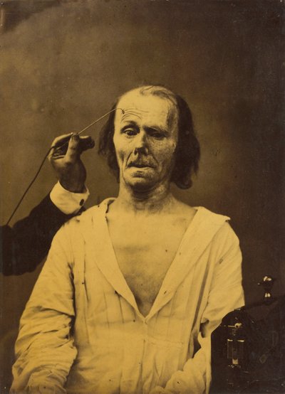 Ett avslappnat ansikte (vänster); Djupgående uppmärksamhet (höger) av Guillaume Benjamin Amant Duchenne