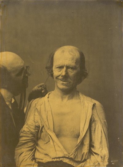 Ein entspanntes Gesicht (links); Falsche Freude oder Lachen (rechts), 1854-1856, gedruckt 1862 von Guillaume-Benjamin-Armand Duchenne de Boulogne