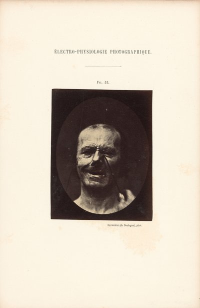 Fotografisk elektrofysiologi, figur 53 av Guillaume Benjamin Duchenne