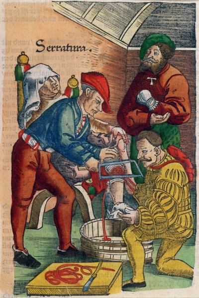 An Amputation, illustration från 