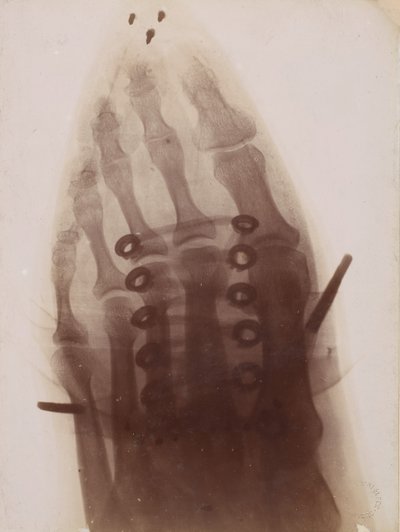 Foten genom skon, 1896. av Henri van Heurck