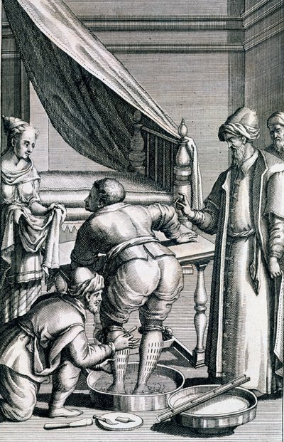 Blodsläpp i benen, från Medicina Aegyptiorum av Prospero Alpini, publicerad 1745 av Italian School