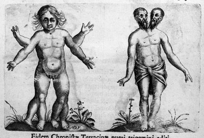 Olika typer av mänskliga monster Gravyr från "Monstrens natur, deras orsaker och skillnader" av Fortunio Whilei (1577-1656), italiensk vetenskapsman. 1646 av Italian School