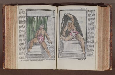 Kvinnlig anatomi, från kommentarer om världens anatomi med de största tilläggen, av Jacopo Berengario da Carpi (c.1460-c.1530) publicerad i Bologna, 1521 (träblock i färg) av Italian School