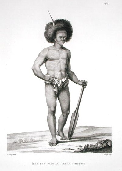 Papuaöarna: Spetälska offer, från "Voyage Autour du Monde (1817-20)", av Louis Claude Desaulses de Freycinet (1779-1842), graverad av Forget, publicerad 1822-24 (litografi). av Jacques Etienne Victor (after) Arago