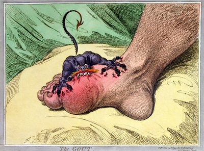 The Gout, publicerad av Hannah Humphrey 1799 (handkolorerad etsning med mjuk botten) av James Gillray