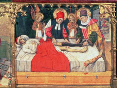 126-0035321 SS. Cosmas och Damian ympar in benet på en etiopisk man på diakonen Justinians stubbe; av Jaume Huguet