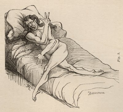 Hysterisk epilepsi, attack, vridningar, fig. 3 från 
