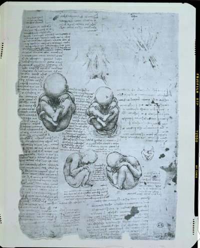 Fem vyer av ett foster i livmodern, faksimilkopia av Leonardo da Vinci