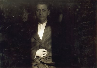 Frank Wiegel från Brooklyn, skadad efter att ha arbetat 18 timmar om dagen vid 15 års ålder, två fingrar amputerades av hans högra hand, New York City av Lewis Wickes Hine