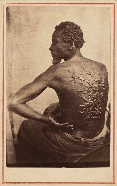 Den plågade ryggen,ca. 1863 (foto) av McPherson & Oliver