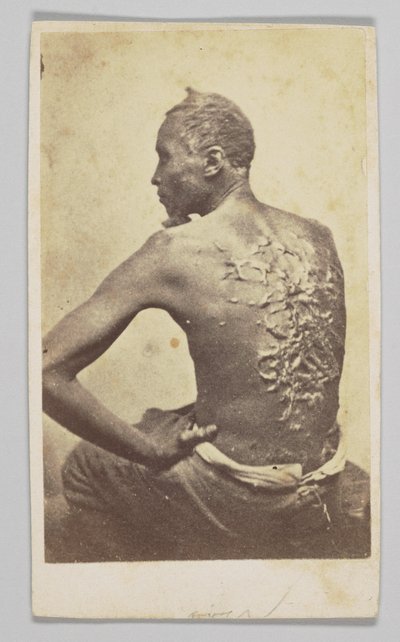 Gordon under medicinsk inspektion, 1863. av McPherson and Oliver