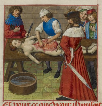 Harley 4425 f.59 Nero ser på när hans mor Agrippina dissekeras, illustration från 