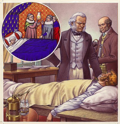 Szenen aus der Medizingeschichte (Gouache auf Papier) von Pat (1907-95) Nicolle