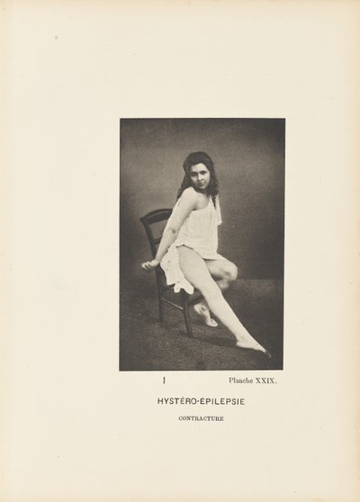 Hystero-epilepsi Kontraktur av Paul Marie Léon Regnard