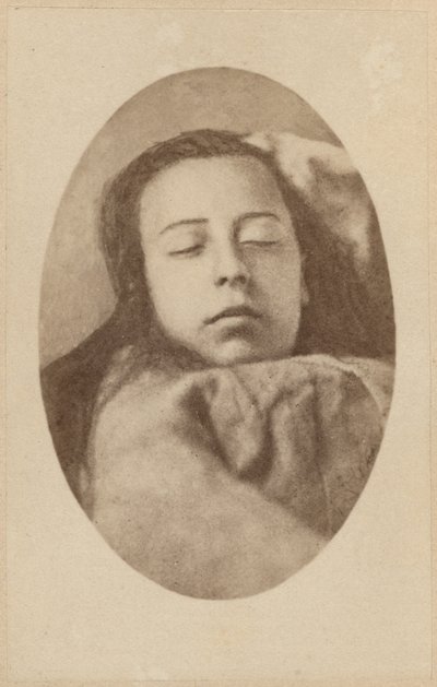 Hysteriattack, andra fasen, illustration från "Iconographie Photographique de La Salpetriere" av Bourneville et P. Regnard, platta III, Paris, 1876 (albumenprint) av Paul Regnard