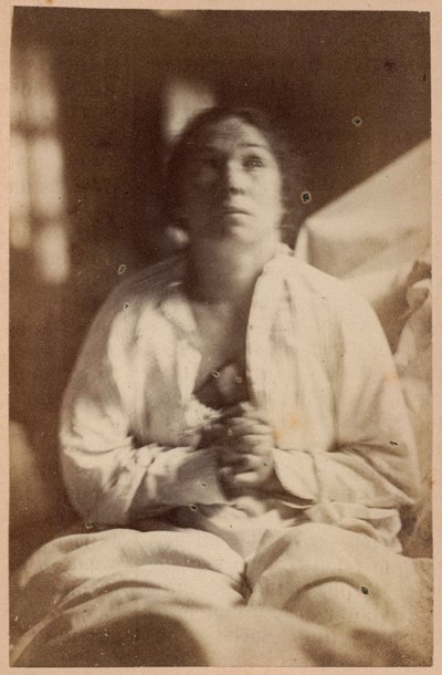 Hysterisk epilepsi, anfall, slutfas, extas, illustration från "Iconographie Photographique de La Salpetriere" av Bourneville et P. Regnard, platta XXII, Paris, 1876 (albumenprint) av Paul Regnard