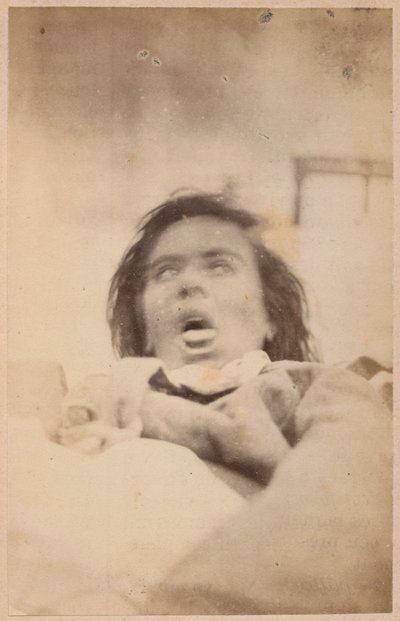 Hysterisk epilepsi, hallucinationer, ångest, tallrik XXIX från 