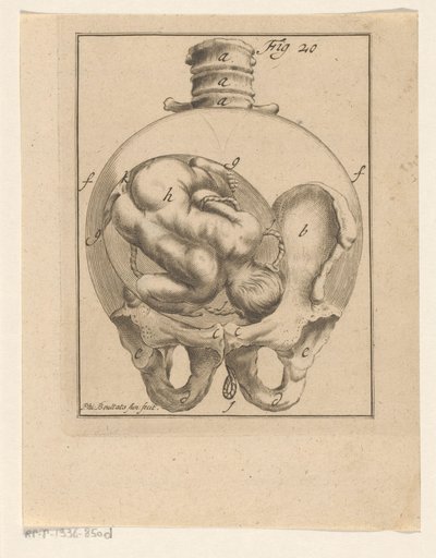 Foster i livmodern Medicinska tryck om graviditet och förlossning (serietitel) av Philibert Bouttats (II)