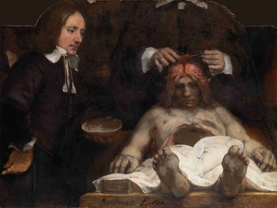 Dr Jan Deijmans anatomilektion, 1656 av Rembrandt van Rijn