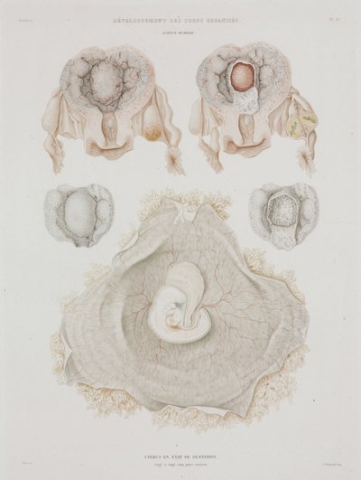 Gynekologi Mänsklig livmoder med embryo, c 1847-1859 av John Pardon